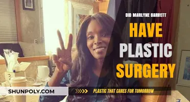 Marlyne Barrett's Transformation: Plastic Surgery Speculations and Truths