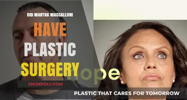 Martha MacCallum Plastic Surgery: Fact-Checking the Rumors and Speculations
