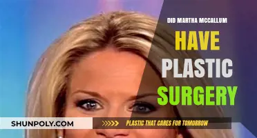 Martha McCallum's Appearance: Plastic Surgery Speculations and Facts