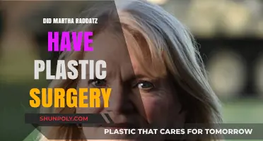 Martha Raddatz Plastic Surgery: Fact-Checking the Rumors and Speculations
