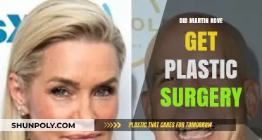 Martin Kove Plastic Surgery: Fact-Checking the Rumors and Speculations