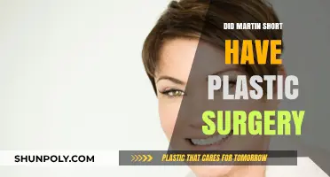 Martin Short Plastic Surgery: Fact-Checking the Rumors and Speculations
