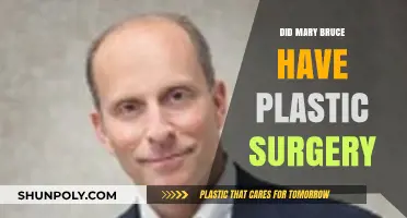 Mary Bruce Plastic Surgery: Fact-Checking the Rumors and Speculations