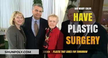 Mary Calvi Plastic Surgery: Fact-Checking the Rumors and Speculations