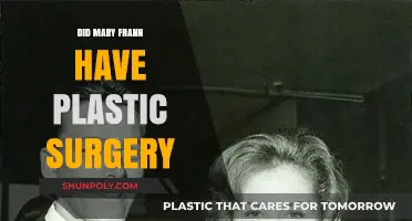 Mary Frann's Transformation: Plastic Surgery Rumors Explored and Debunked