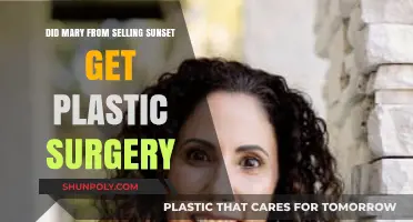 Mary Fitzgerald's Transformation: Plastic Surgery Rumors on Selling Sunset