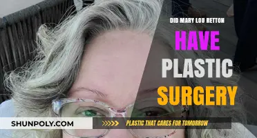 Mary Lou Retton Plastic Surgery: Fact-Checking the Rumors and Speculations