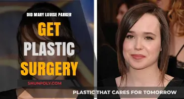 Mary Louise Parker Plastic Surgery: Fact-Checking the Rumors and Speculations