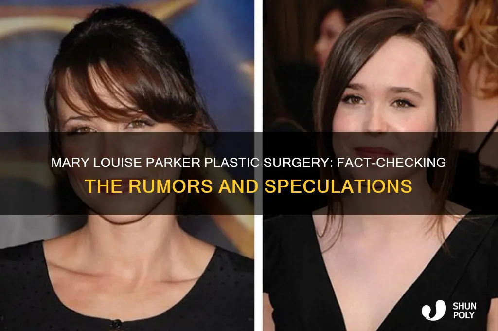 did mary louise parker get plastic surgery