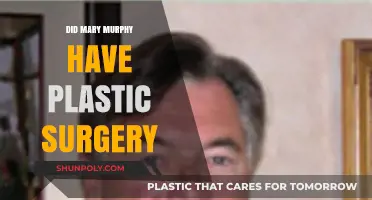 Mary Murphy's Transformation: Plastic Surgery Rumors Explored and Debunked