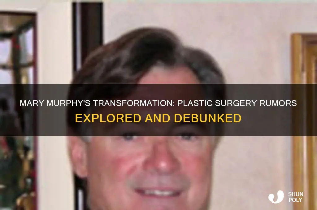 did mary murphy have plastic surgery
