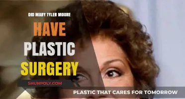 Mary Tyler Moore's Transformation: Plastic Surgery Speculations Explored