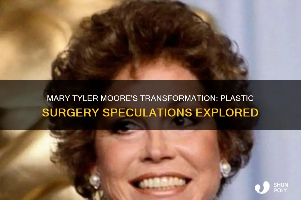 did mary tyler moore have plastic surgery