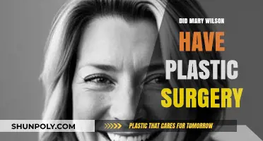Mary Wilson's Transformation: Unveiling the Truth About Plastic Surgery