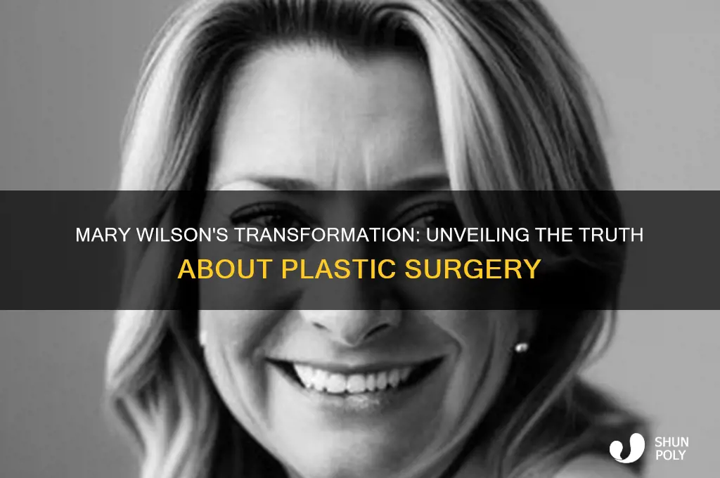 did mary wilson have plastic surgery