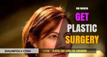 Marzia's Transformation: Plastic Surgery Rumors and the Truth Behind Them