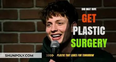 Did Mat Rife Undergo Plastic Surgery? Uncovering the Truth