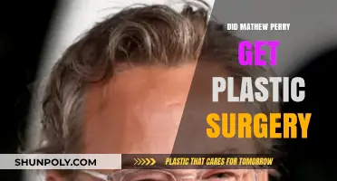 Mathew Perry's Transformation: Plastic Surgery Rumors Explored