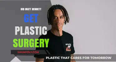 Matt Bennett Plastic Surgery: Fact-Checking the Transformation Rumors