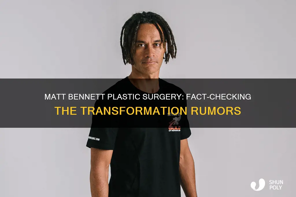 did matt bennett get plastic surgery