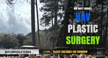 Matt Berkey Plastic Surgery: Fact-Checking the Rumors and Speculations