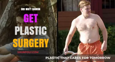 Matt Damon's Transformation: Plastic Surgery Rumors Explored and Debunked