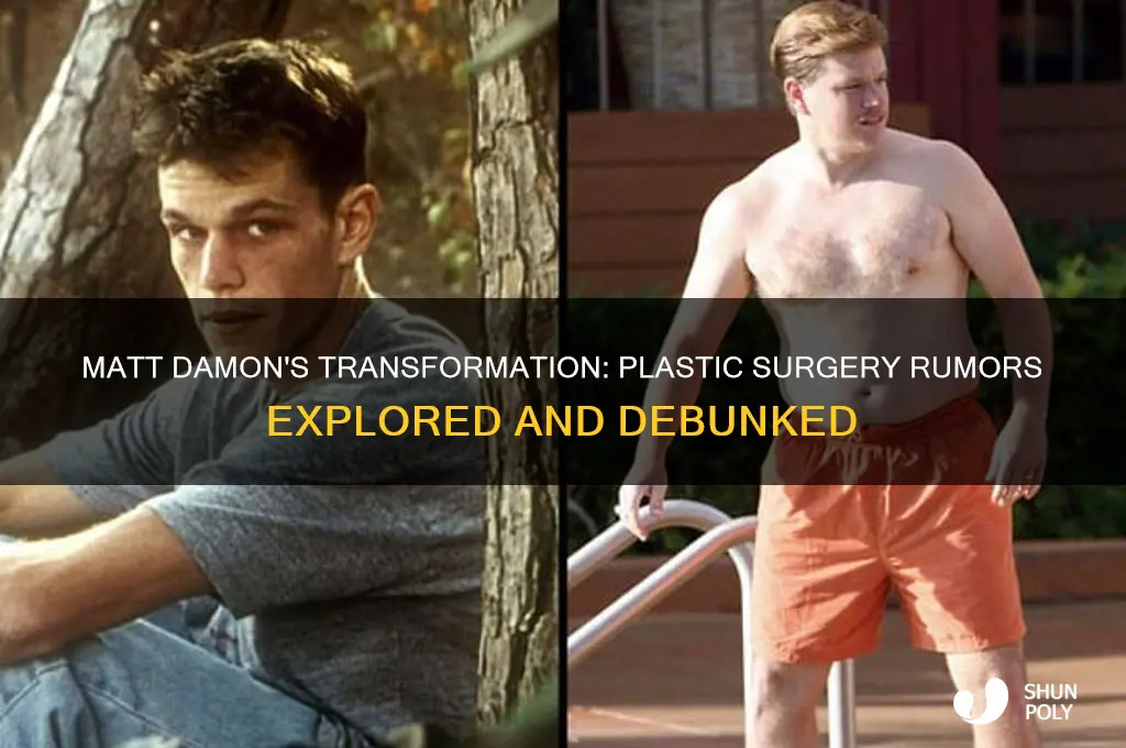 did matt damon get plastic surgery