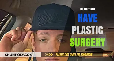Matt Ride's Transformation: Plastic Surgery Rumors Explored and Debunked