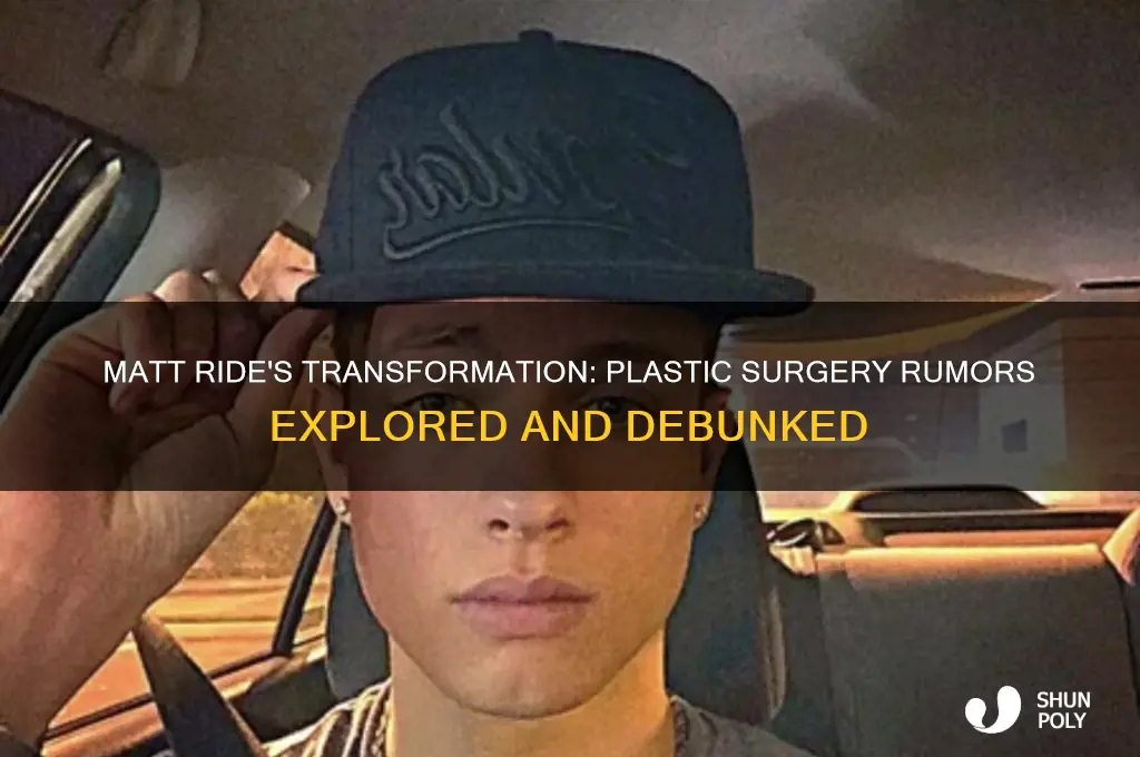 did matt ride have plastic surgery
