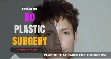 Matt Rife Plastic Surgery: Fact-Checking the Rumors and Speculations