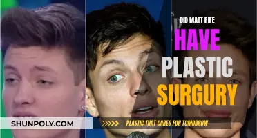 Matt Rife's Plastic Surgery: What's the Truth?
