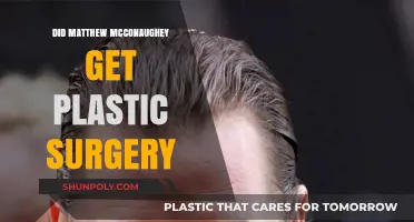 Matthew McConaughey's Transformation: Plastic Surgery Rumors Explored