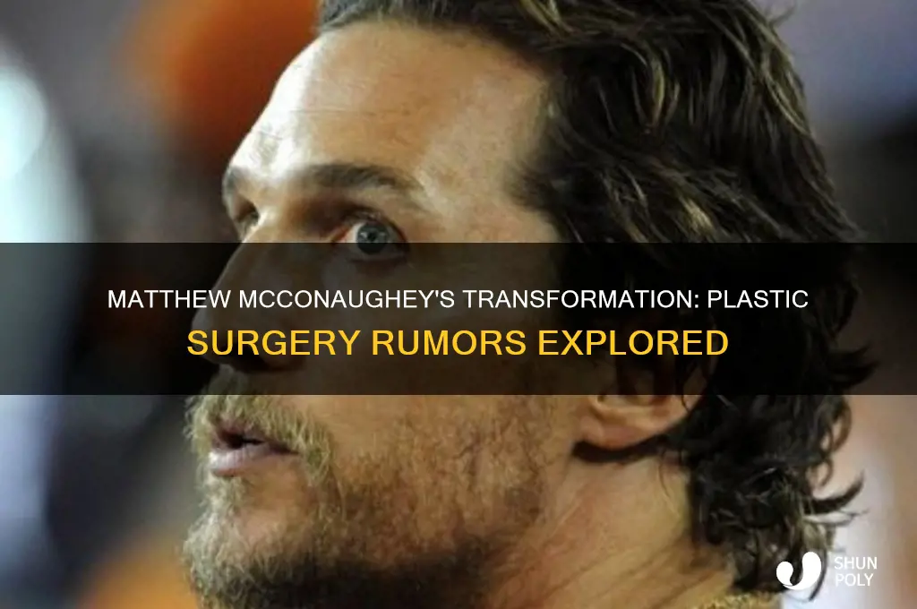 did matthew mcconaughey get plastic surgery