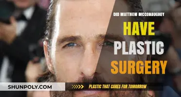 Matthew McConaughey's Transformation: Plastic Surgery Rumors Explored