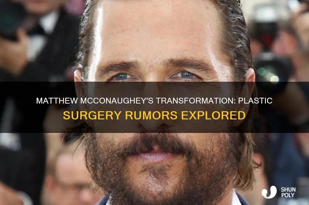 did matthew mcconaughey have plastic surgery