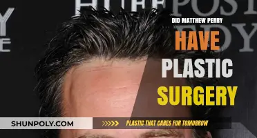 Matthew Perry's Transformation: Plastic Surgery Speculations and Facts Revealed