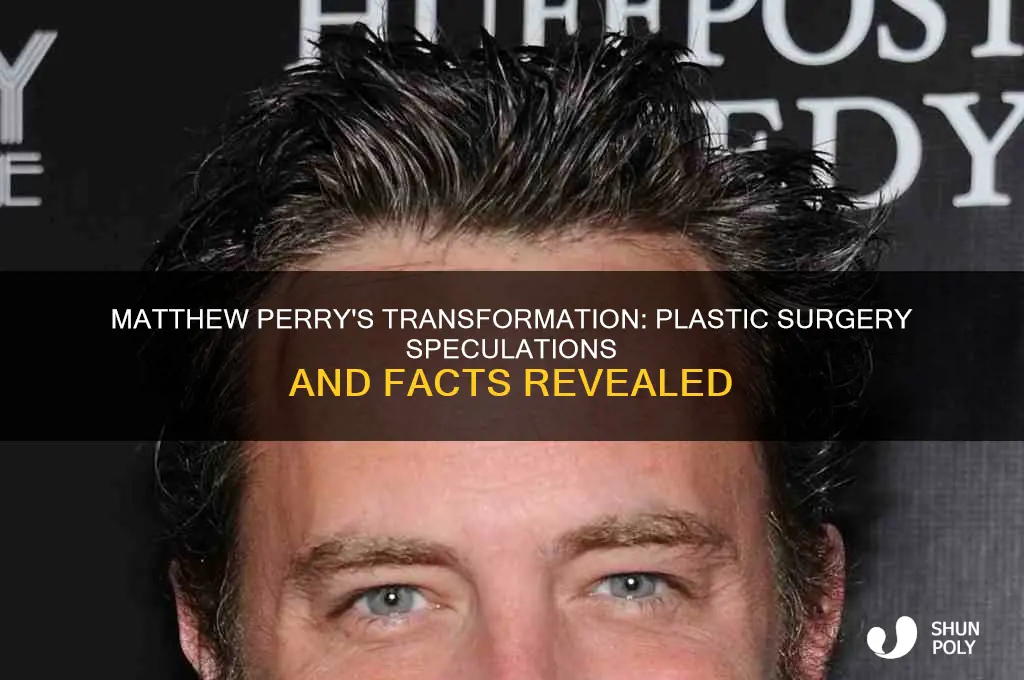 did matthew perry have plastic surgery