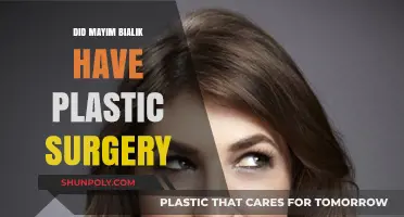 Mayim Bialik Plastic Surgery: Fact-Checking the Rumors and Speculations