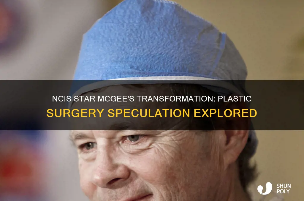 did mcgee on ncis have plastic surgery