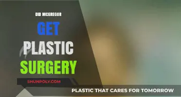 Did Conor McGregor Undergo Plastic Surgery? Unveiling the Truth