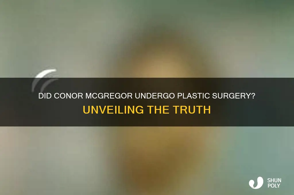 did mcgregor get plastic surgery