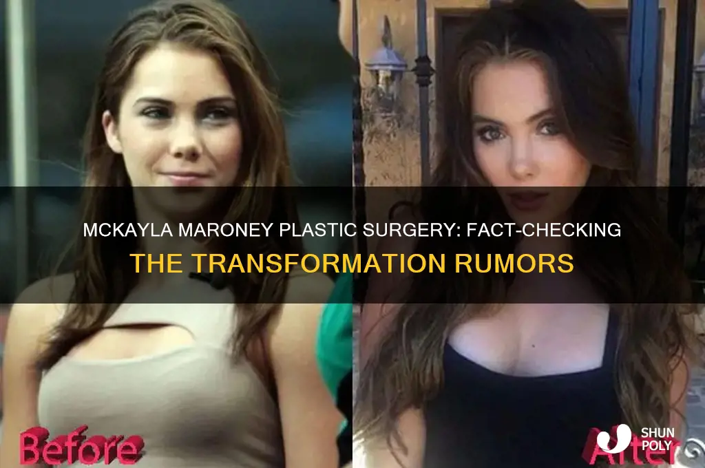 did mckayla maroney get plastic surgery