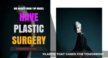 McKey from Top Model: Plastic Surgery Rumors Explored