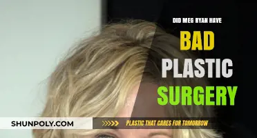 Meg Ryan's Plastic Surgery: Transformation Gone Wrong or Unfair Criticism?