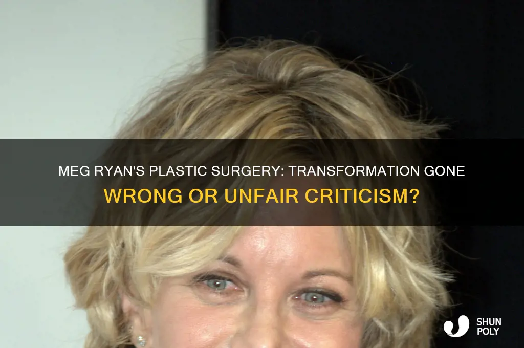 did meg ryan have bad plastic surgery