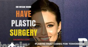 Megan Boone's Transformation: Plastic Surgery Rumors Explored and Debunked