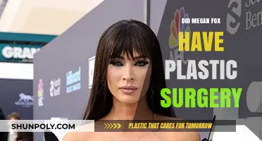 Megan Fox's Transformation: Plastic Surgery Rumors and Reality Revealed