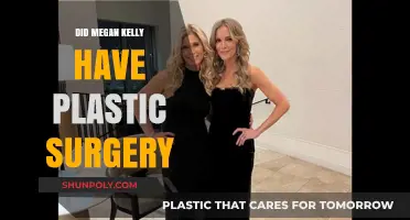 Megan Kelly's Transformation: Plastic Surgery Rumors Explored and Debunked