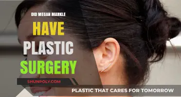 Megan Markle's Transformation: Plastic Surgery Rumors Explored and Debunked