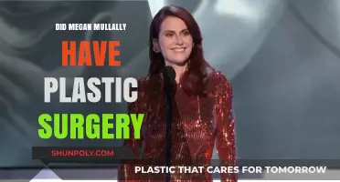 Megan Mullally's Transformation: Plastic Surgery Rumors Explored